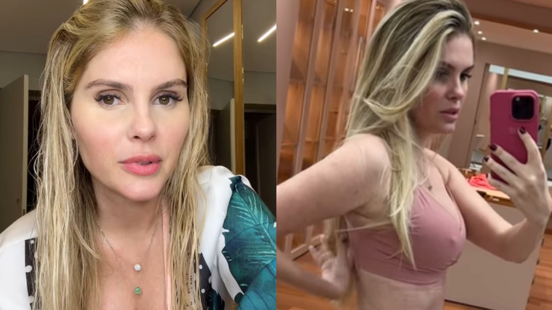 Bárbara Evans mostra recuperação do corpo após cirurgias plásticas