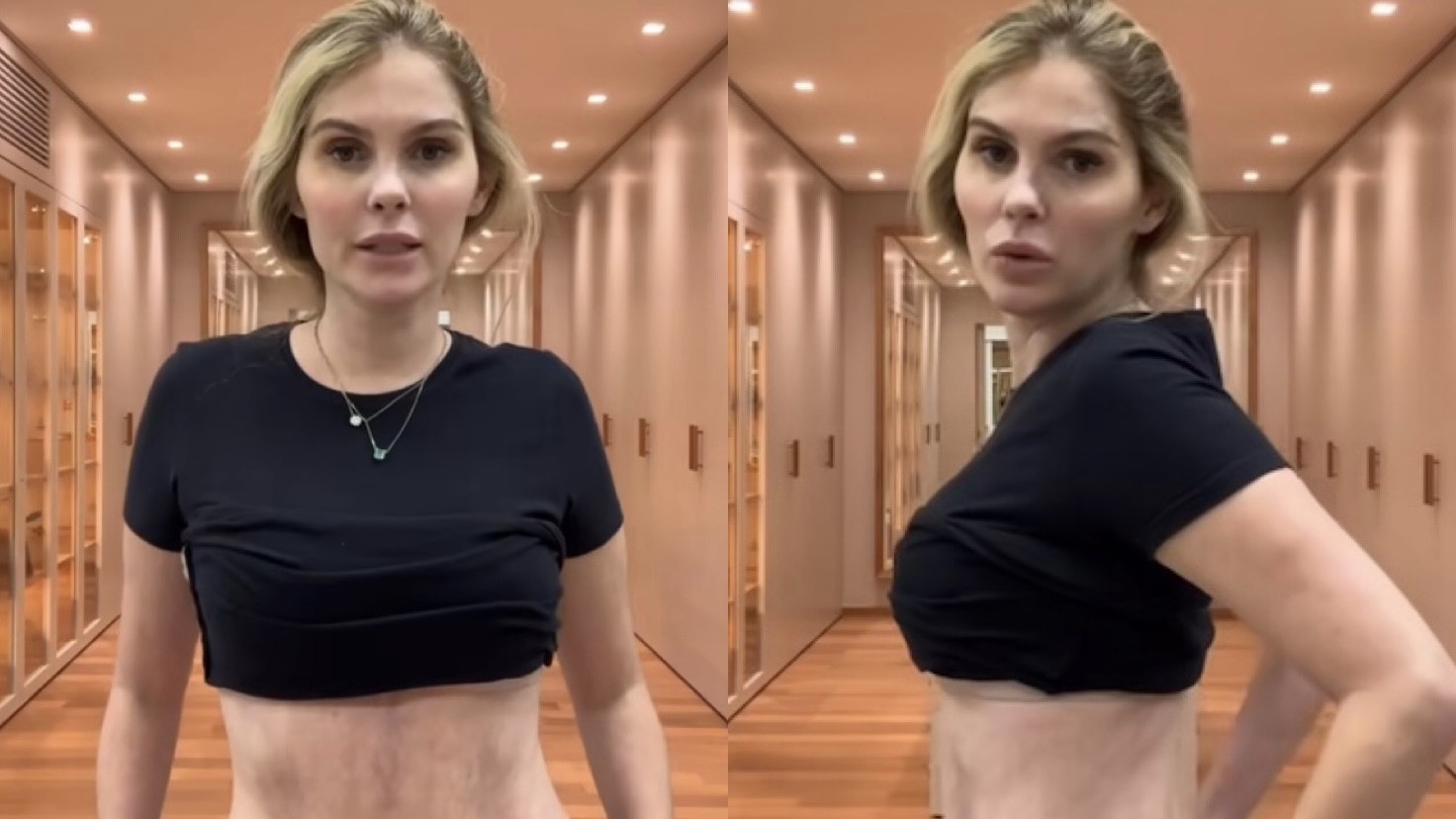 Bárbara Evans mostra evolução da cicatriz de cirurgias plásticas: ‘Estou roxa’