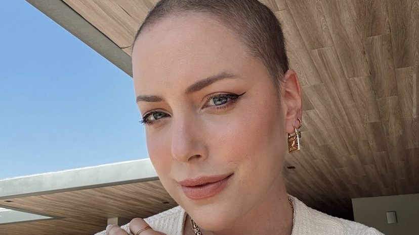 Fabiana Justus comemora quatro meses da pega da medula óssea: ‘Renasci’