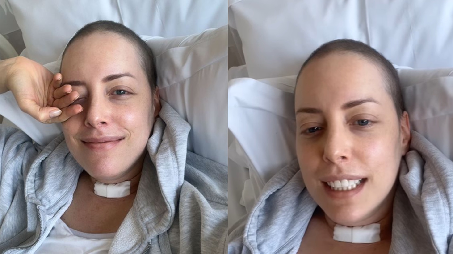 Fabiana Justus conta detalhes de sua recuperação após cirurgia