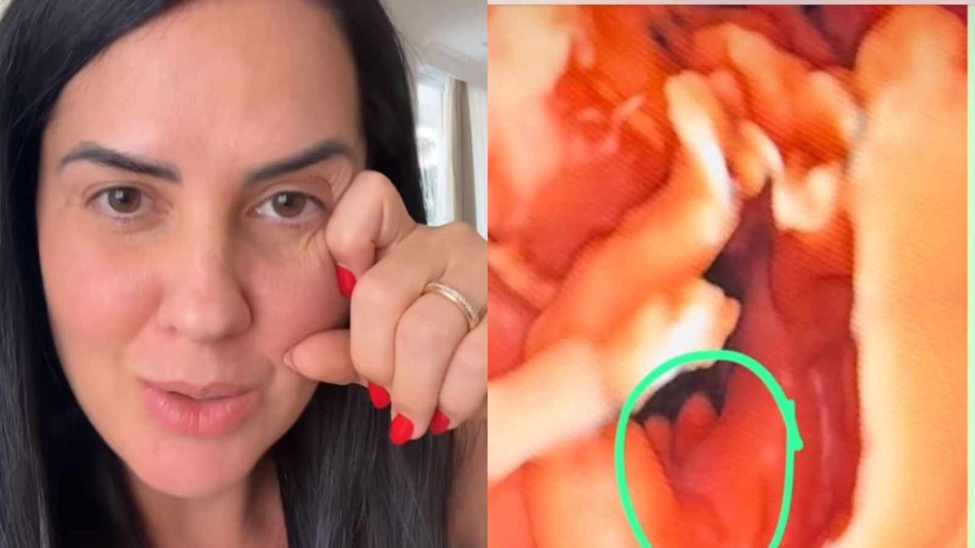 Graciele Lacerda se desespera ao mostrar ultrassom e receber ‘revelação’