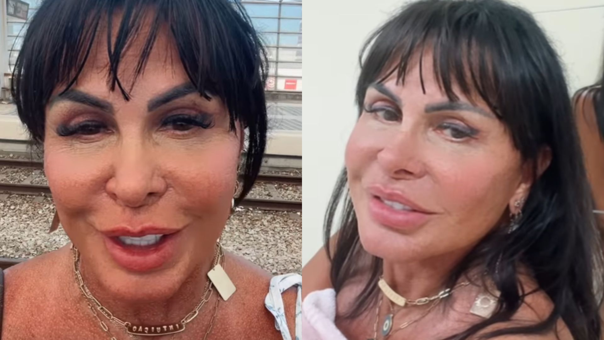 Gretchen mostra resultado de novo procedimento: ‘Não tem photoshop’