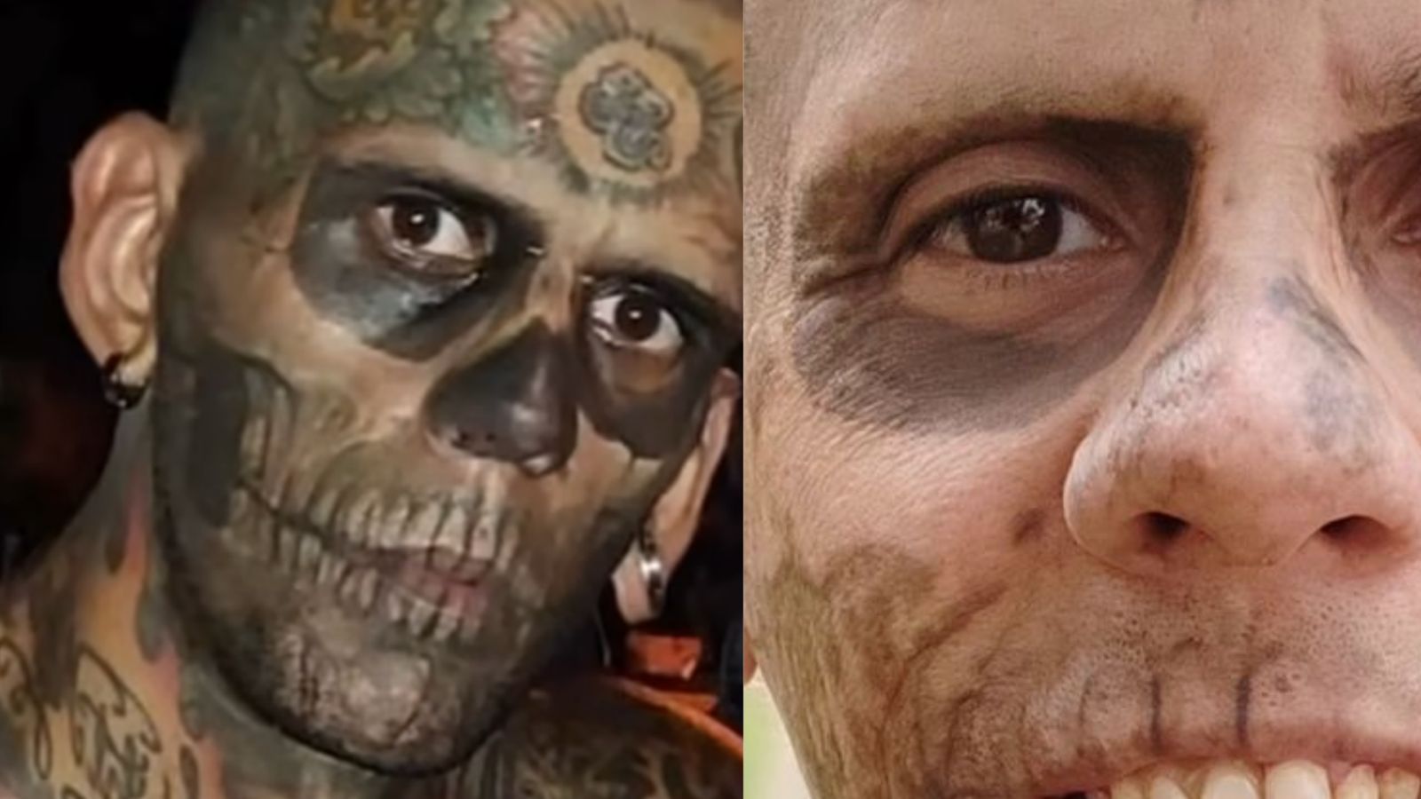 Homem mais tatuado do Brasil toma decisão drástica e remove tatuagens