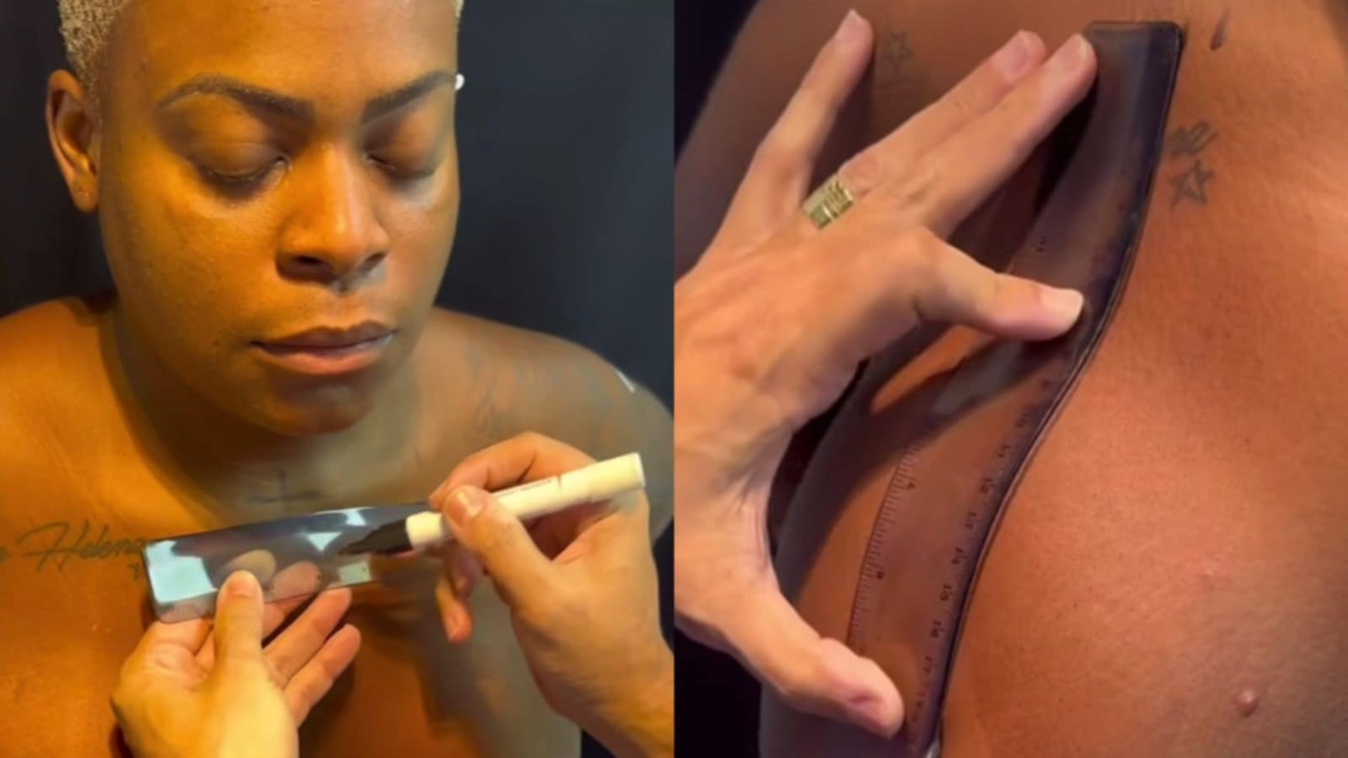 Jojo Todynho mostra vídeo de sua cirurgia nas mamas; veja o antes e depois