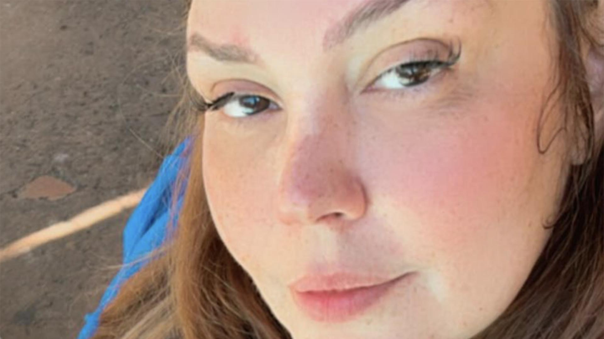 Simony mostra o tamanho do cabelo natural após a luta contra o câncer