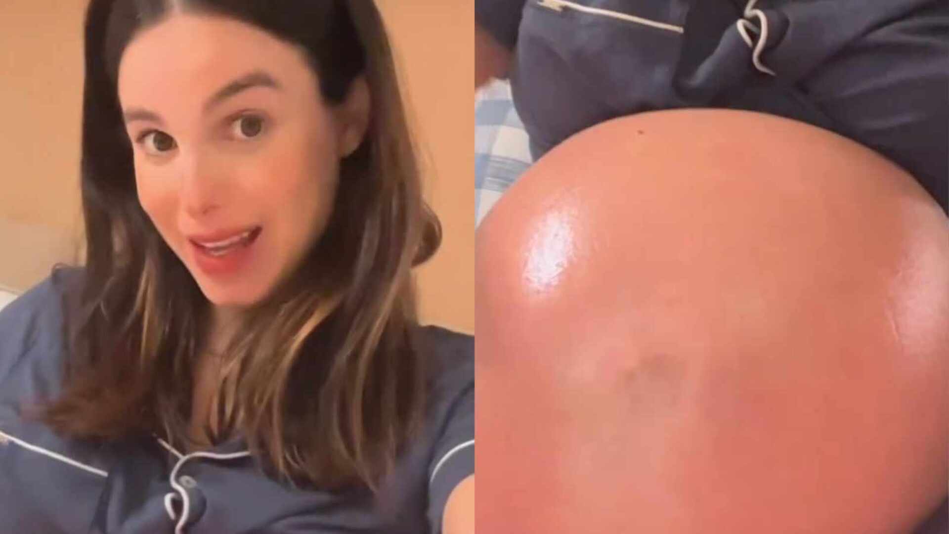 No fim da gravidez, Sthefany Brito choca ao mostra barriga muito vermelha