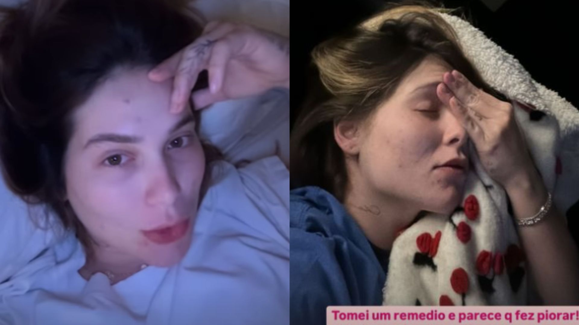Virginia mostra método inusitado para aliviar dor de cabeça: ‘Melhorou’