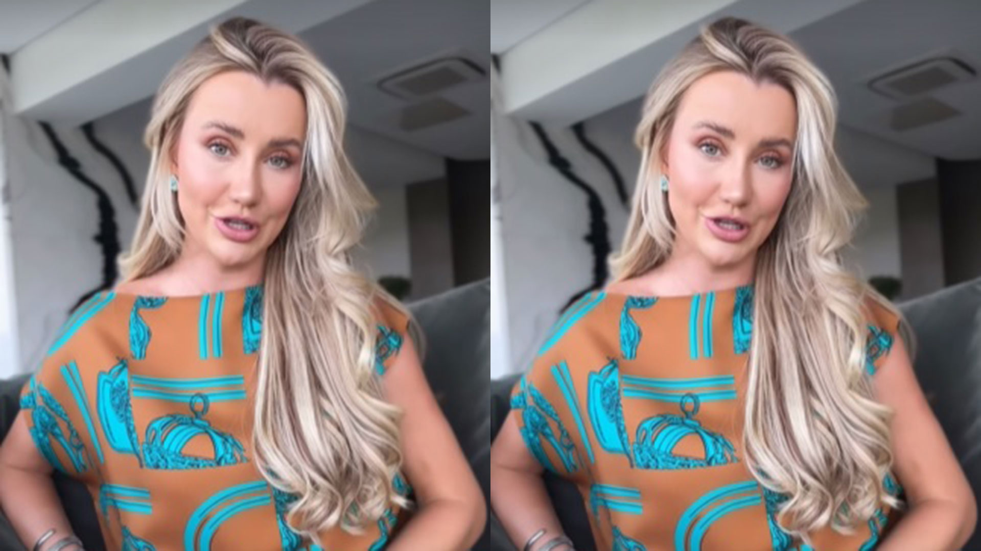 Ana Paula Siebert explica sobre cirurgia: ‘Muito rara’