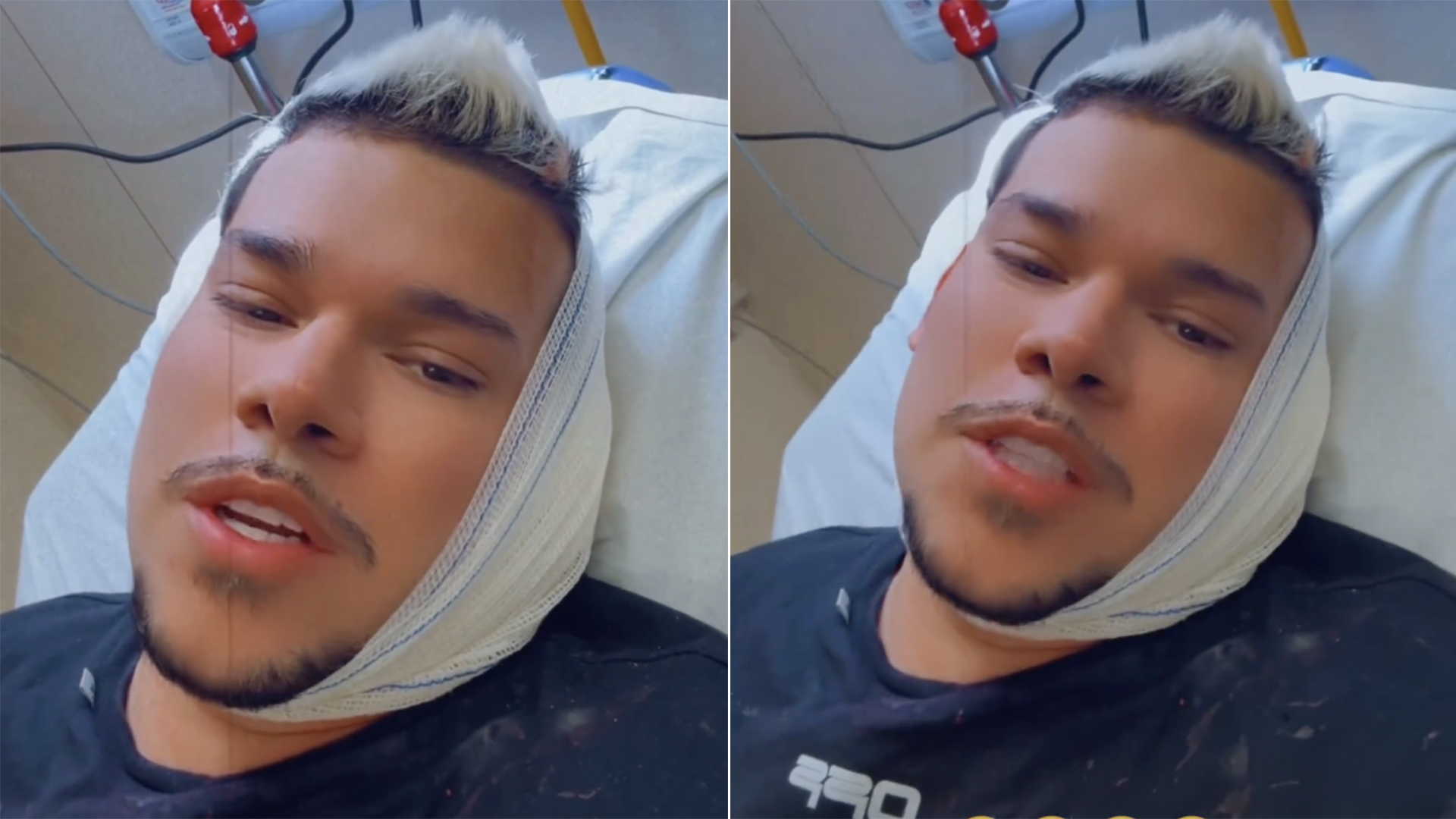 Buarque vai parar no hospital e passará por cirurgia: ‘Cheio de dor’