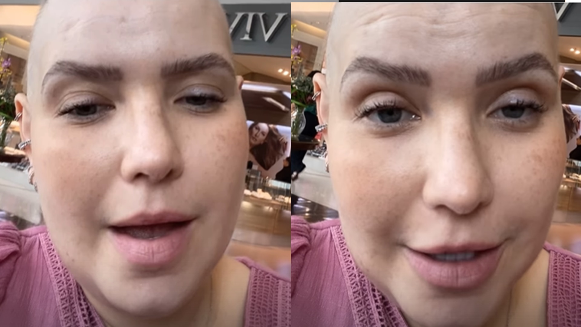 Camila Campos explica uso de cinta em meio a tratamento de câncer
