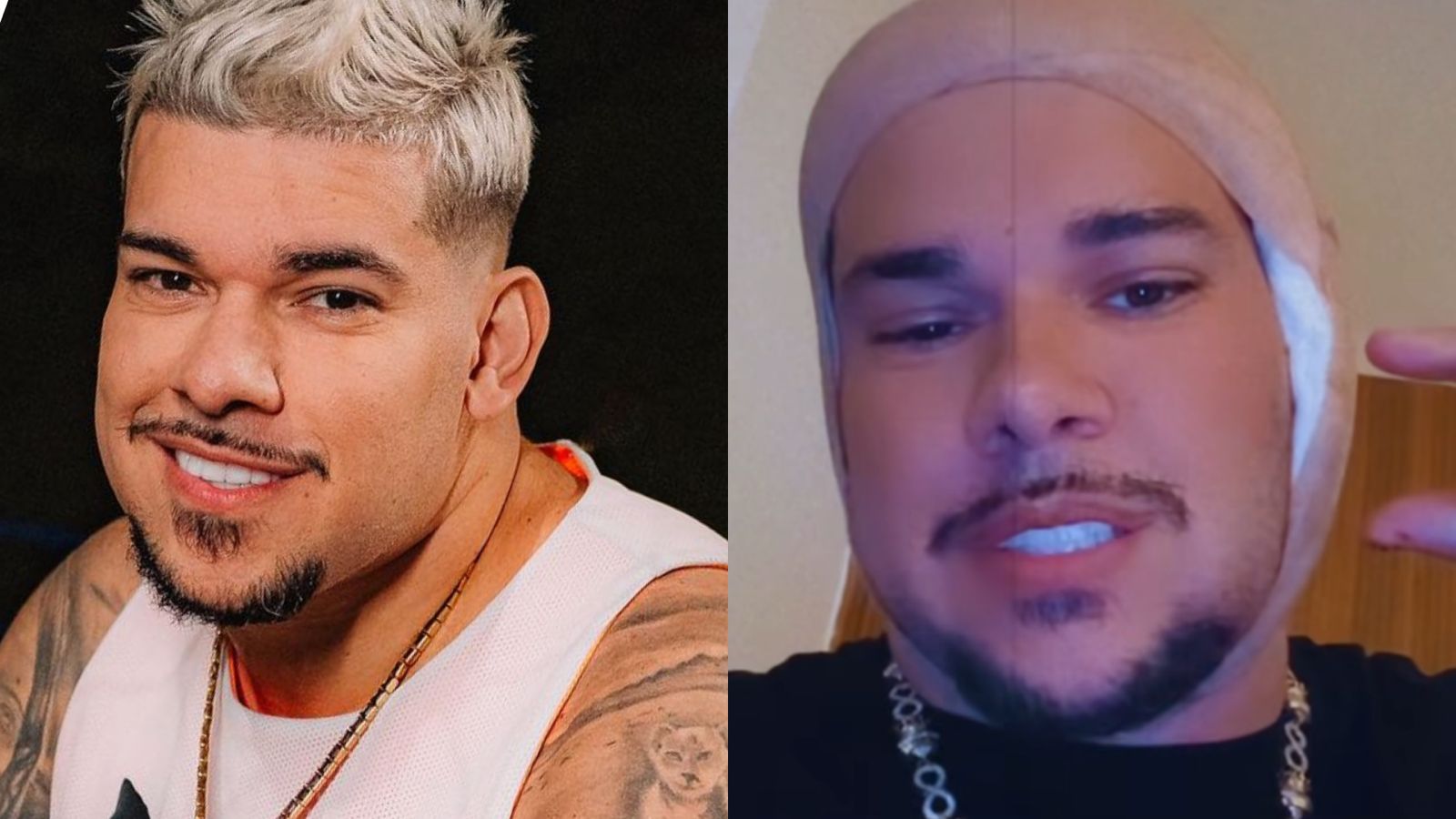 DJ Buarque nega ter causado acidente de propósito após perder parte da orelha