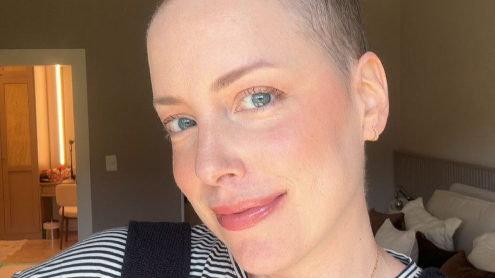 Fabiana Justus compartilha tamanho do cabelo após sessões de quimioterapia