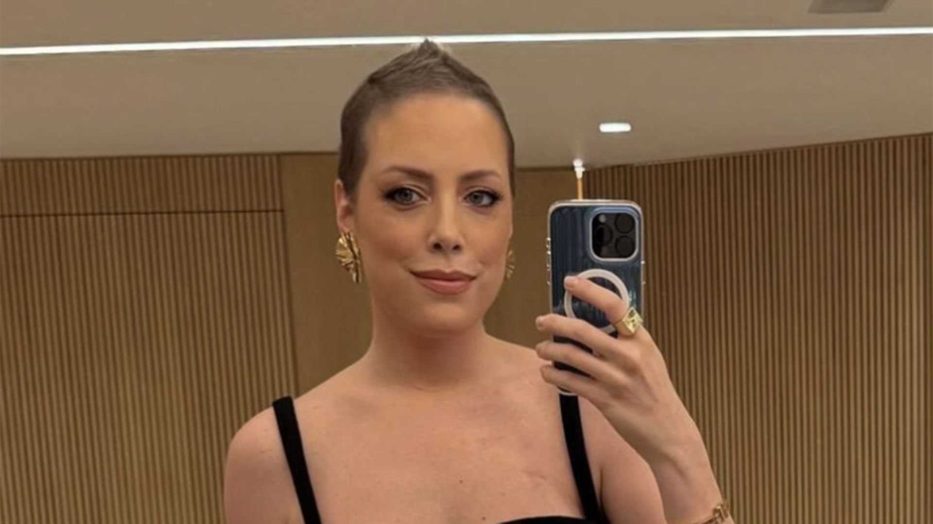 Fabiana Justus revela novo passo do tratamento após o câncer