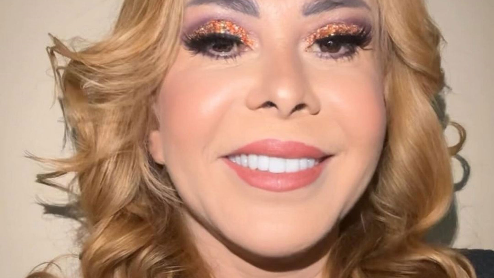 Após sofrer lesão, Joelma faz exercícios e avisa: ‘Estou voltando’