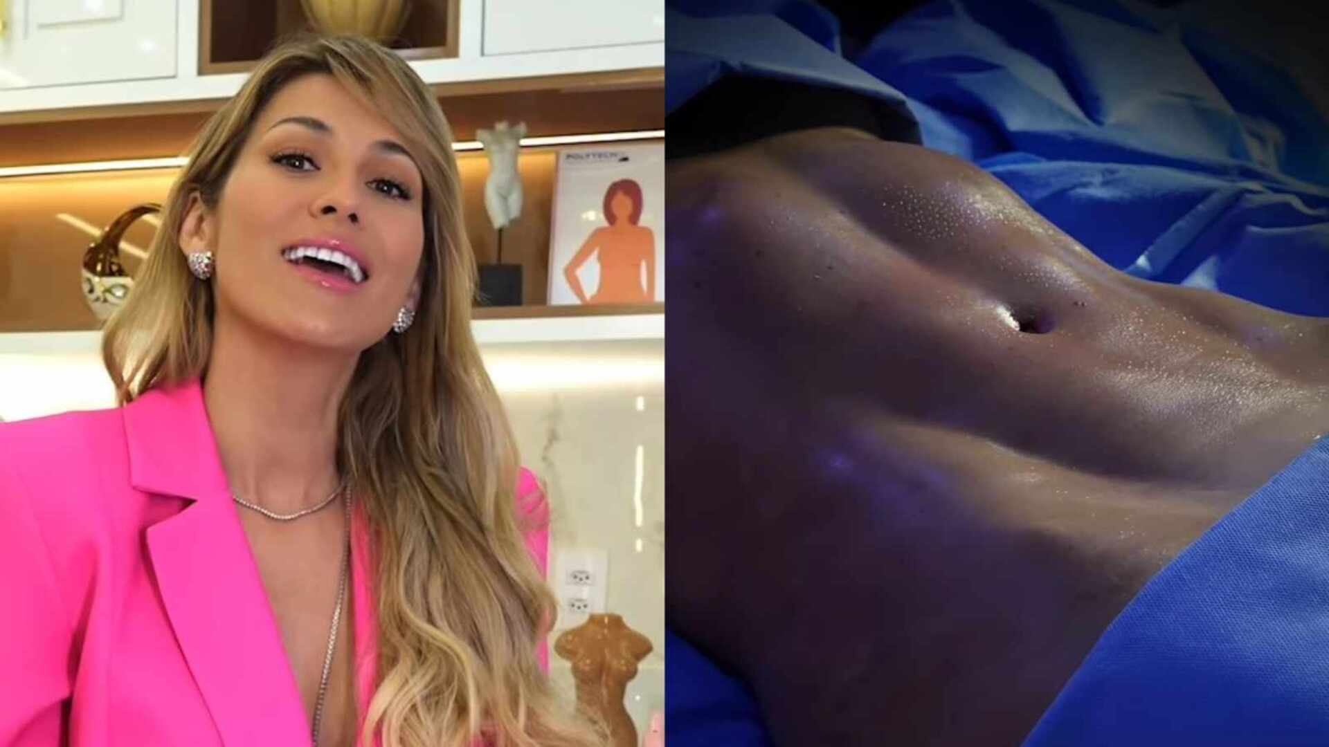 Lívia Andrade faz lipoaspiração e choca com resultado: ‘Chegou minha vez’
