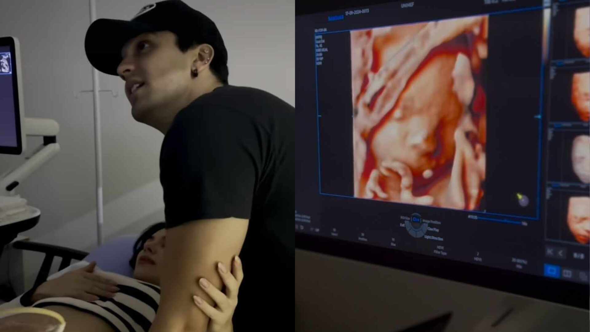 Luan Santana e Jade Magalhães mostram pela 1ª vez o ultrassom do bebê