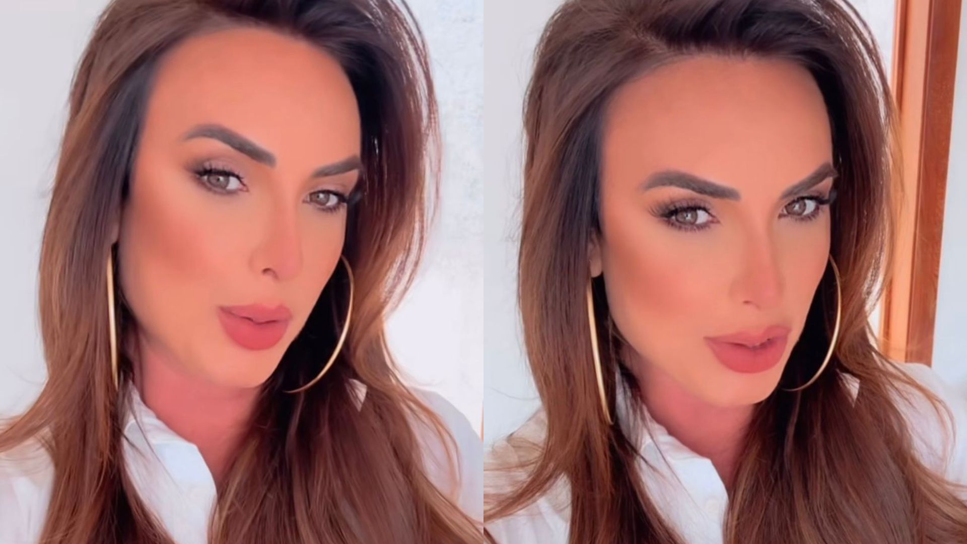 Nicole Bahls revela detalhes de cirurgia plástica: ‘Sou uma embalagem’