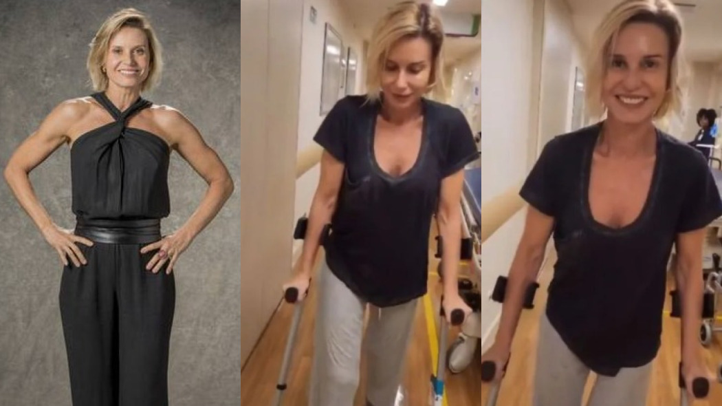 O que Paula Burlamarqui tem? Entenda o que é osteoartrite de quadril