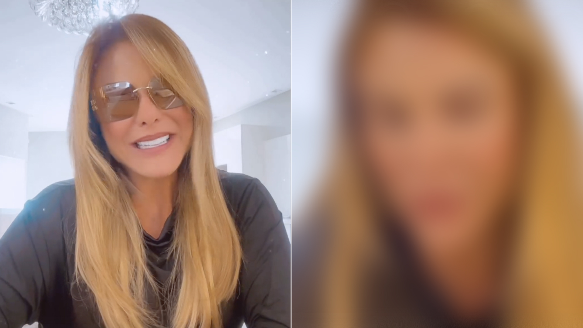 Esposa de Leonardo, Poliana Rocha faz cirurgia em detalhe do seu rosto
