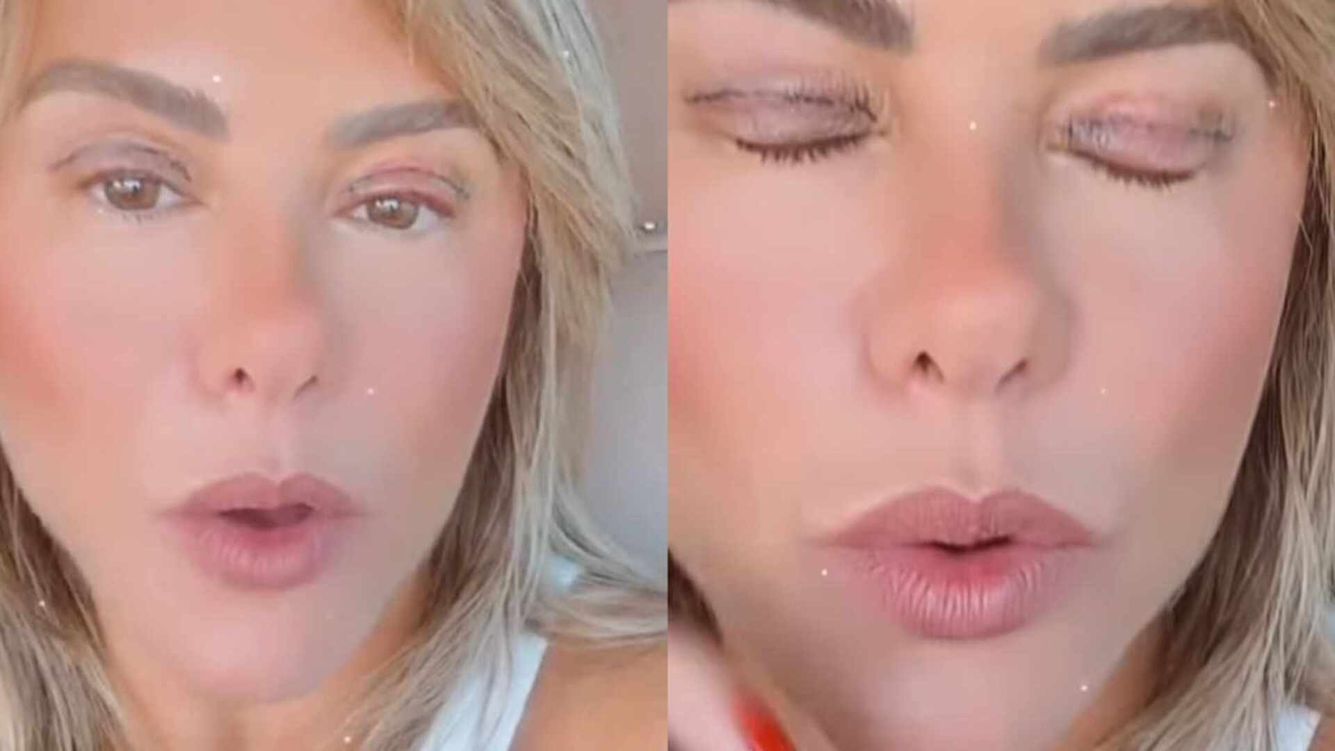 Poliana Rocha mostra cicatriz de seu olho após cirurgia: ‘Pretinho’