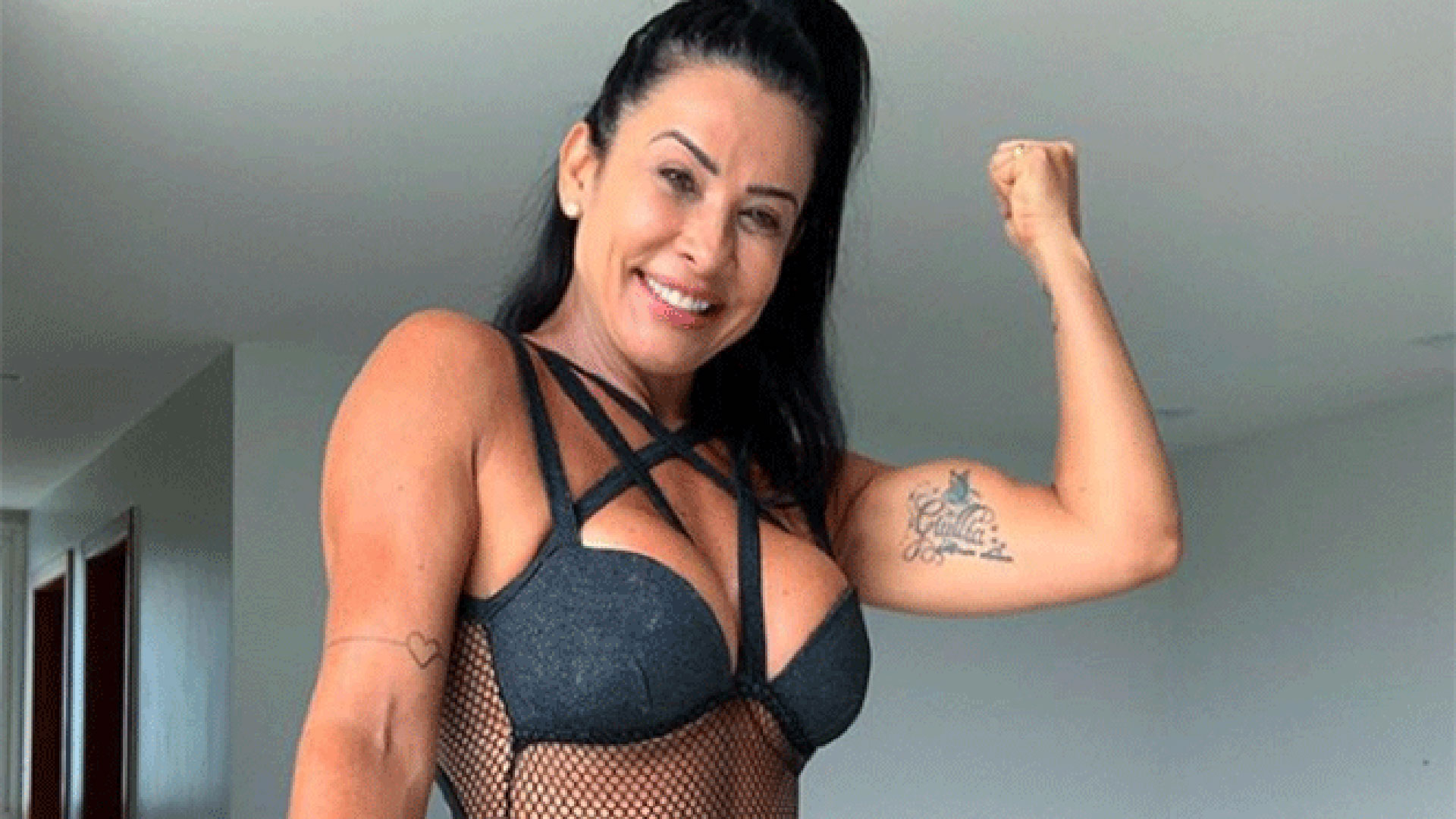 Scheila Carvalho decide remover ácido hialurônico do rosto
