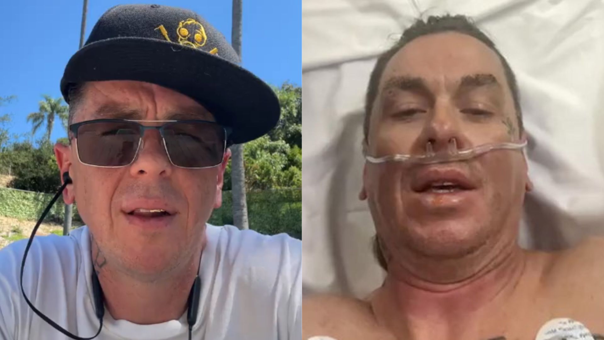 Sid Wilson, do Slipknot, detalha acidente com fogueira que ‘derreteu seu rosto’