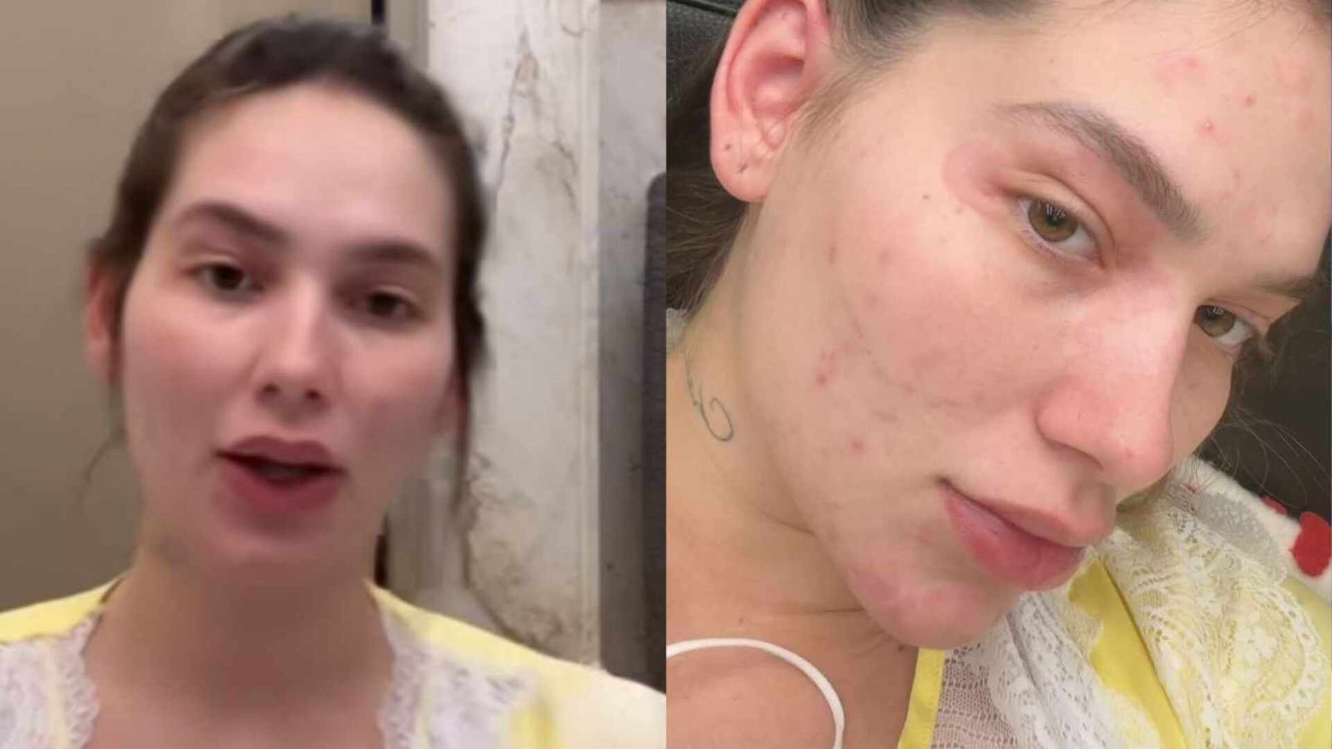 Sofrendo alergia, Virginia Fonseca enfrenta perrengue em sua mansão