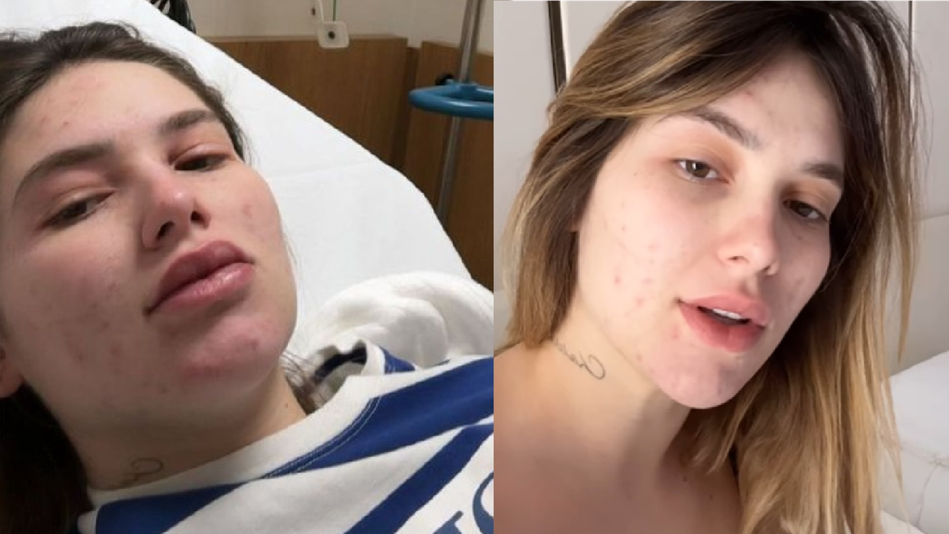 Virginia Fonseca revela motivo da reação alérgica que a levou ao hospital