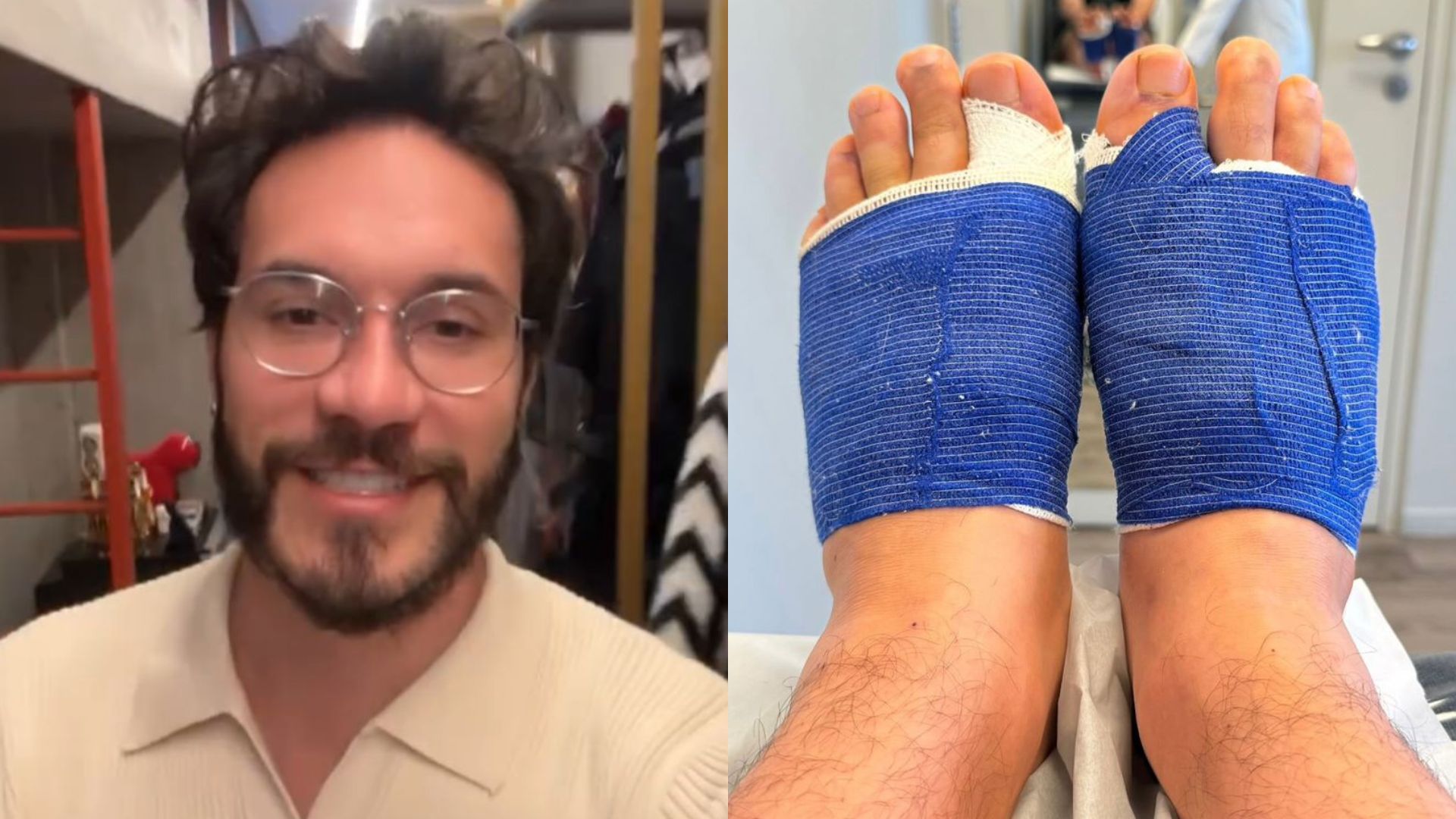 Eliezer exibe resultado de cirurgia após retirada dos joanetes