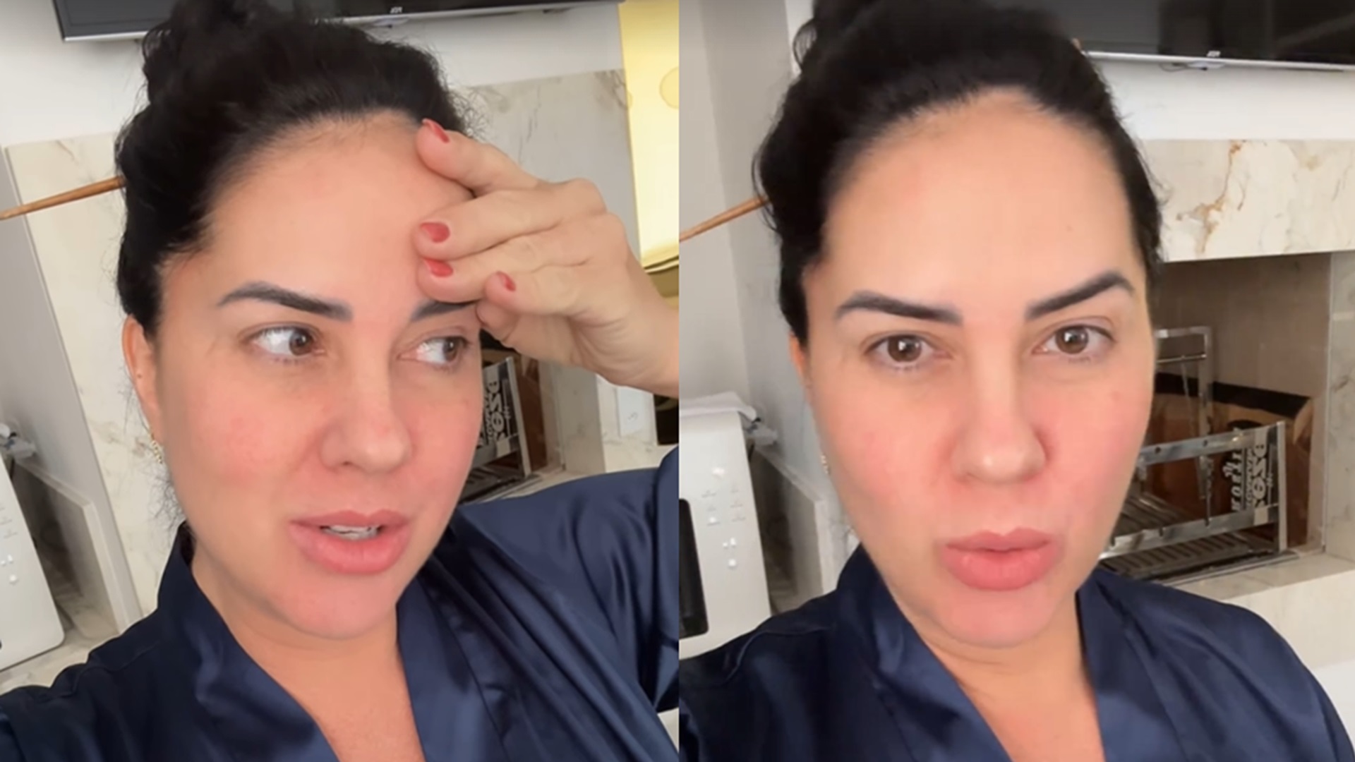 Graciele Lacerda volta a sofrer com sintoma na gravidez: ‘De repente’