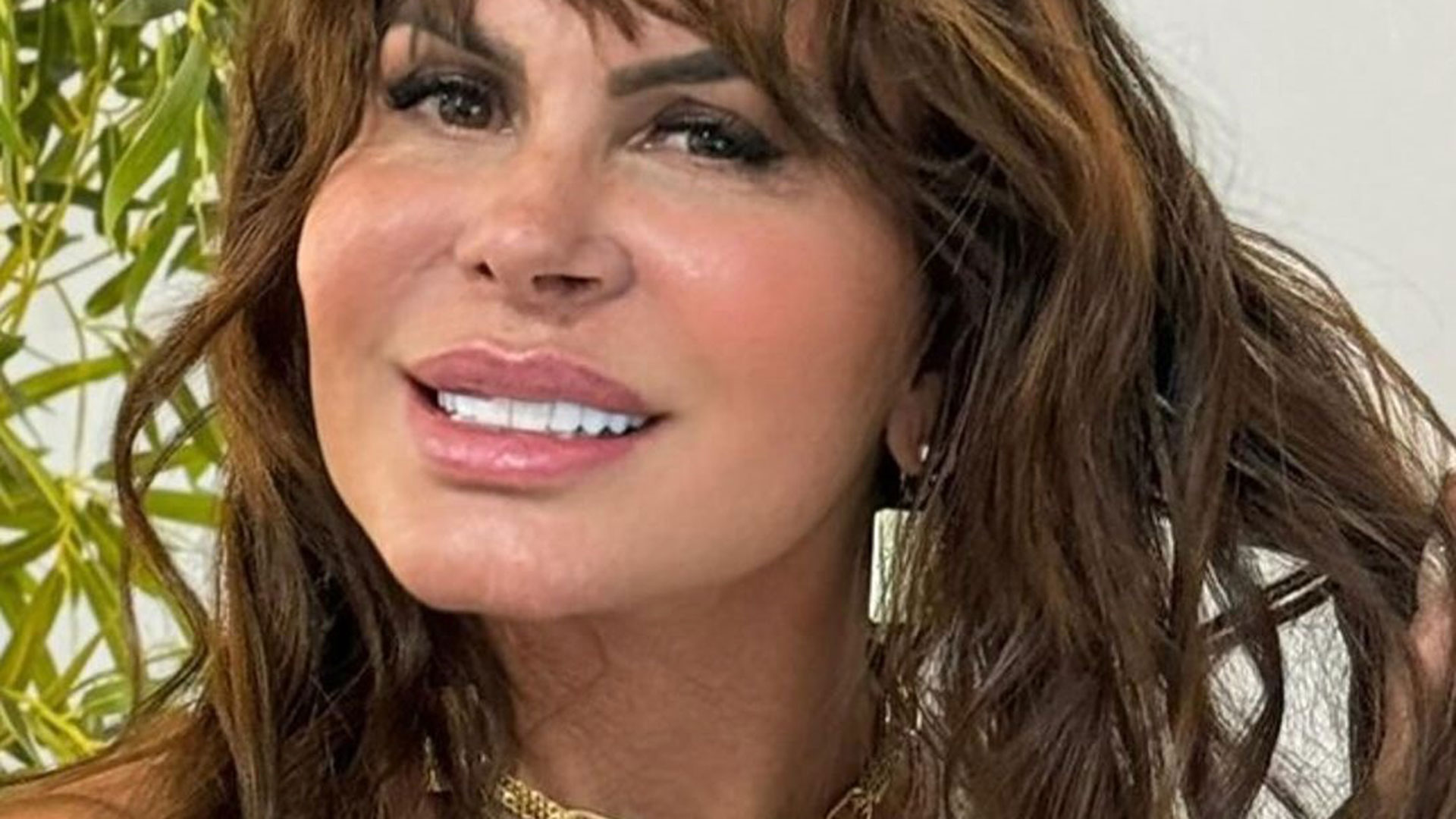 Gretchen rebate críticas após afirmar que fará transplante capilar
