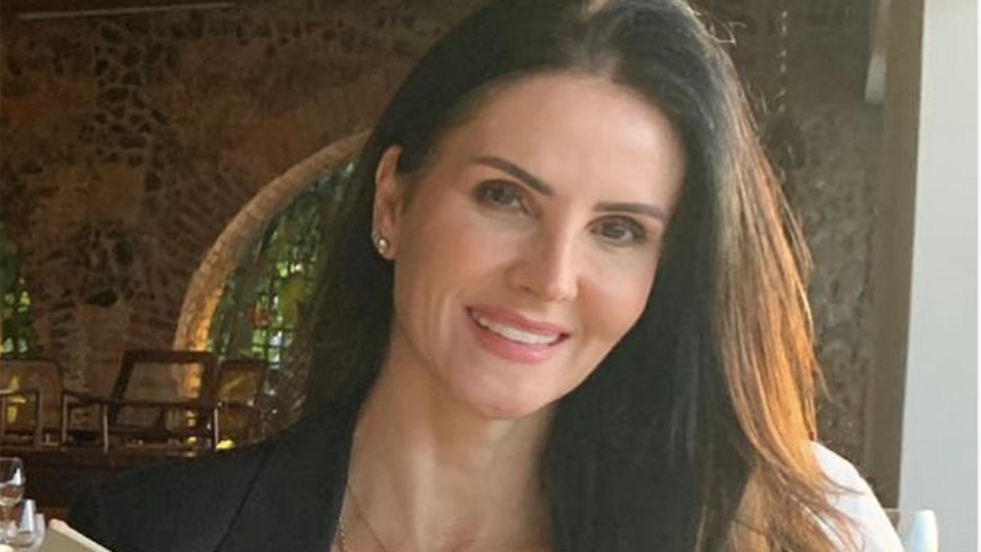 Lisandra Souto revela que fez transplante de sobrancelha
