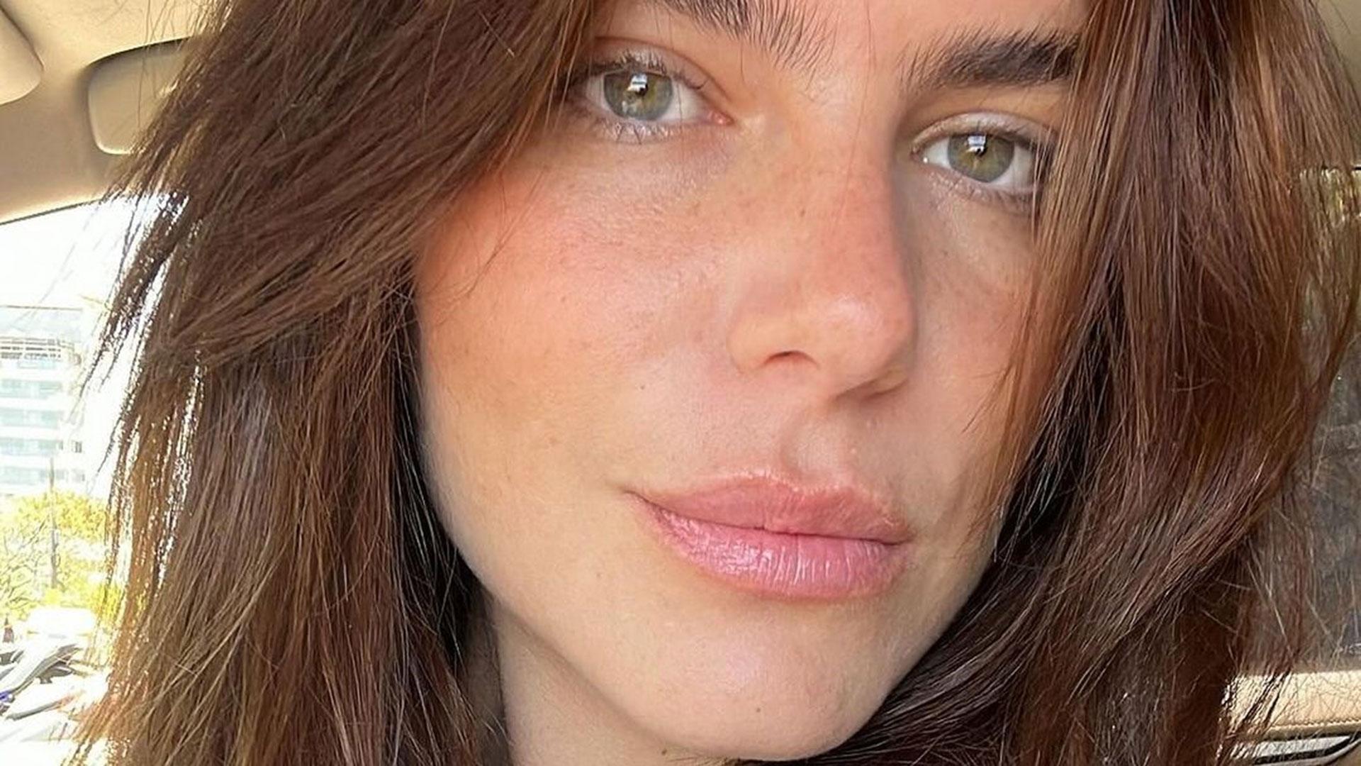 Mariana Goldfarb relembra luta contra a anorexia: ‘Fiquei muito fraca’