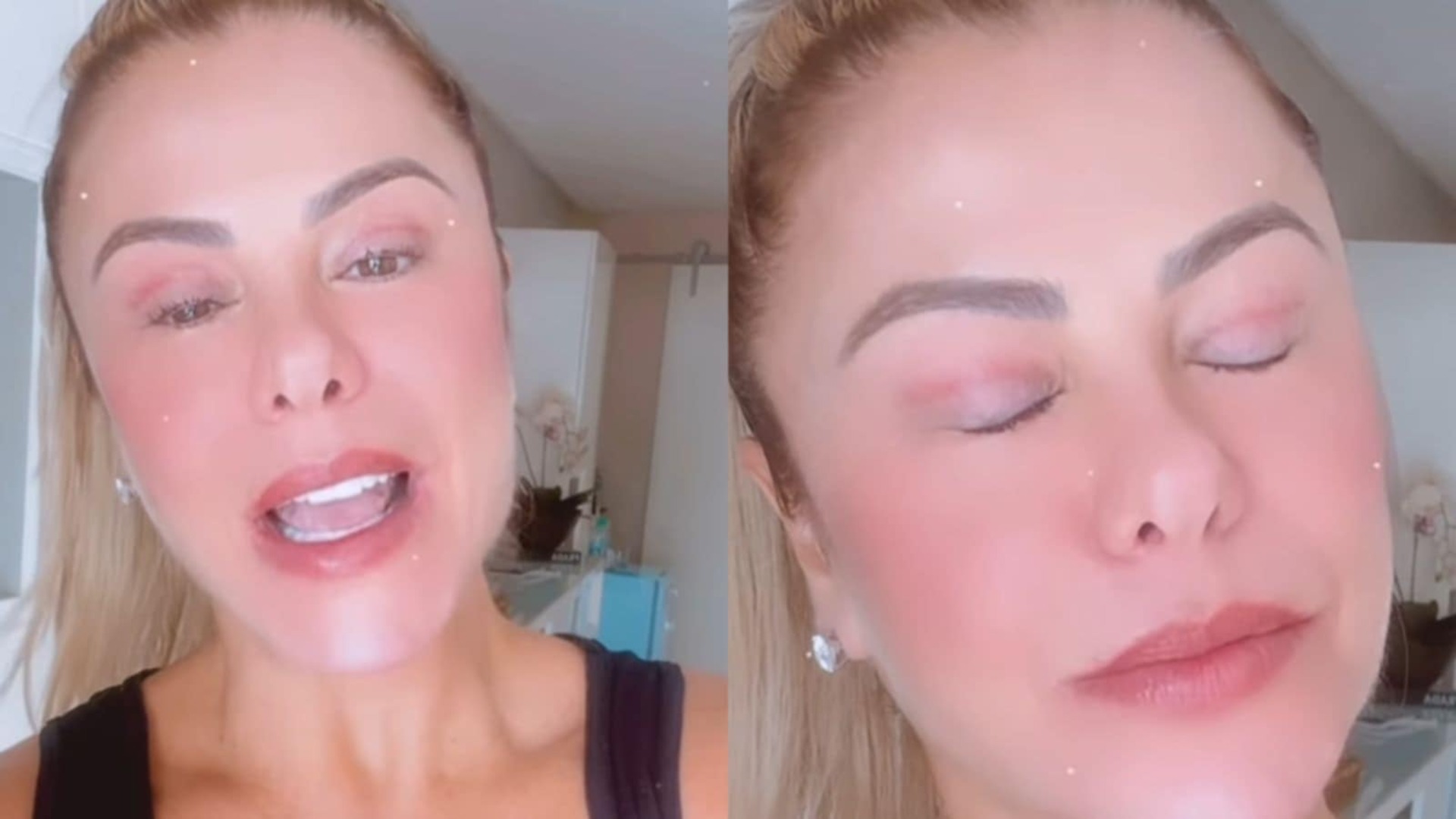 Poliana Rocha fala sobre cicatriz nos olhos ter ficado vermelha; veja