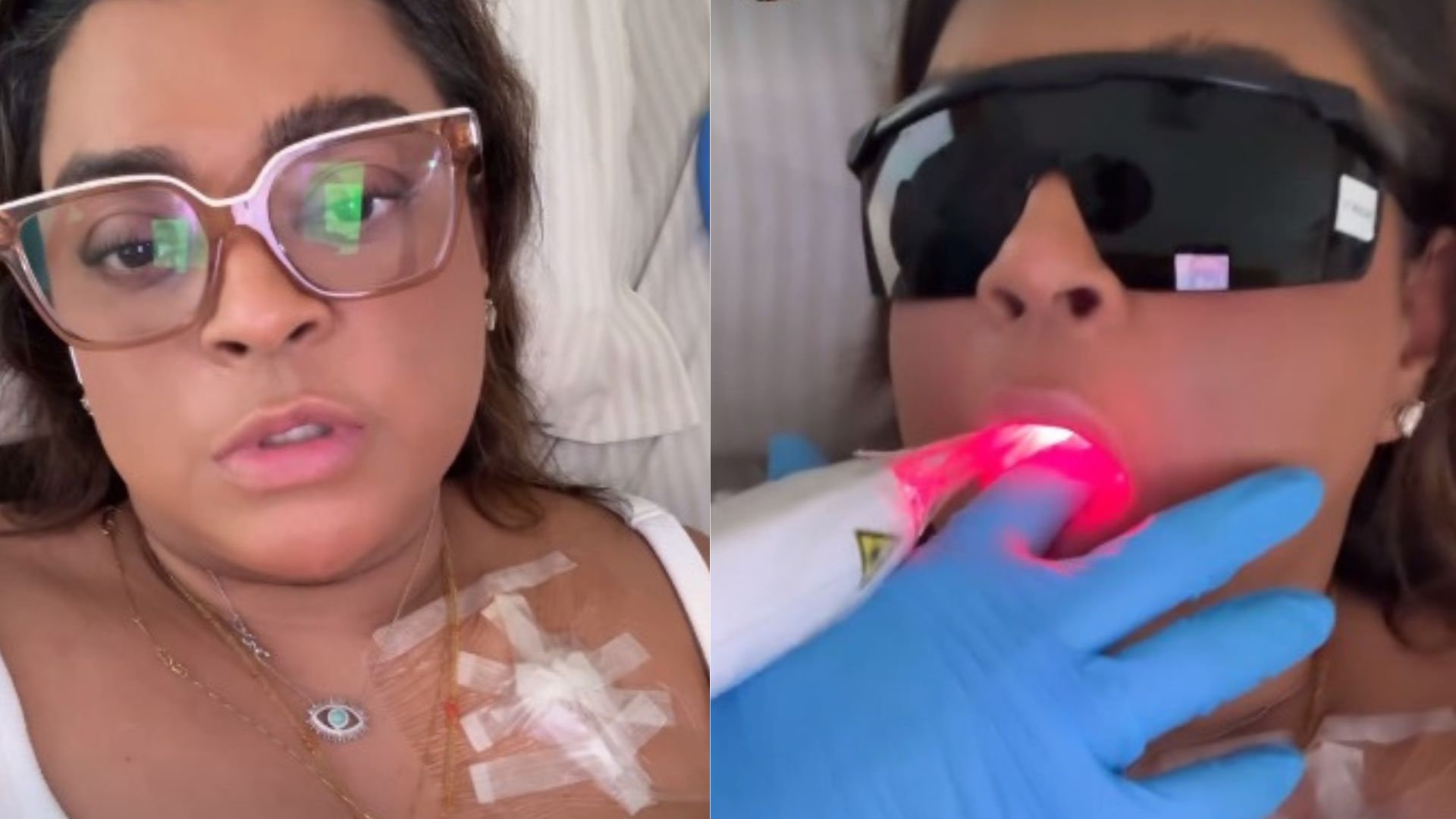 Preta Gil faz tratamento com laser dentro da boca e explica o motivo