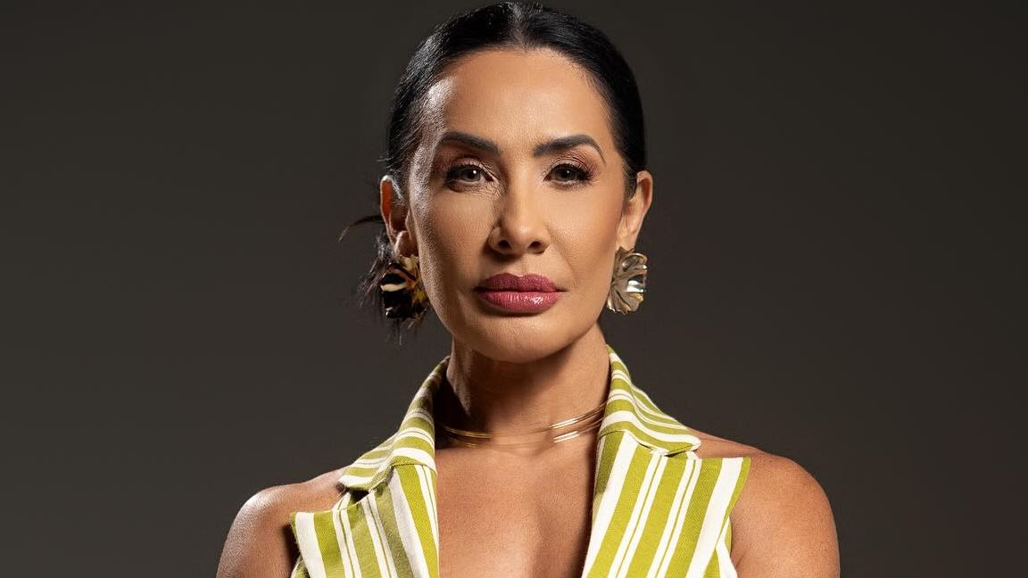 Scheila Carvalho retira harmonização facial; especialista detalha antes e depois
