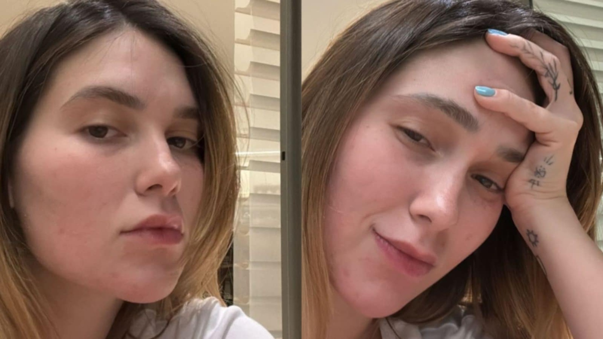 Sofrendo com dores, Virginia fala sobre possibilidade de tirar o silicone