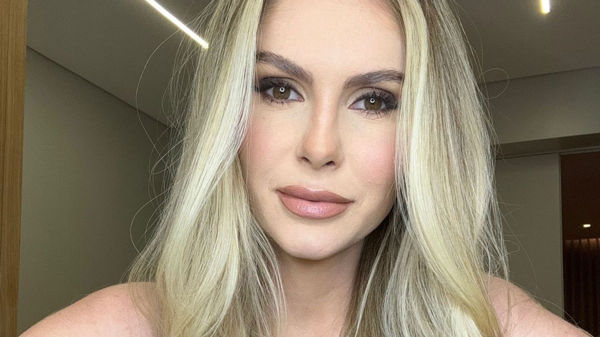 Bárbara Evans faz procedimentos estéticos no rosto e mostra o resultado