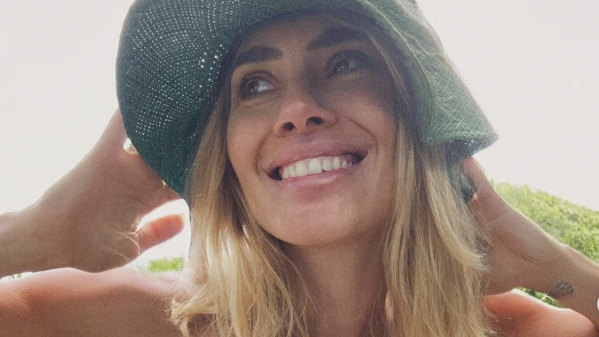 Carolina Dieckmann mostra o machucado após queda em gravação