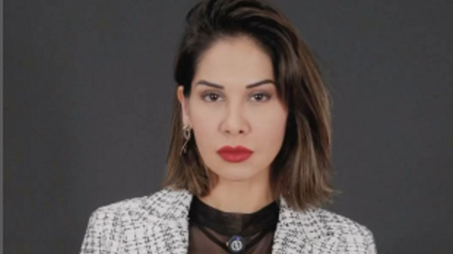 Médica faz importante alerta sobre futura cirurgia de Maíra Cardi
