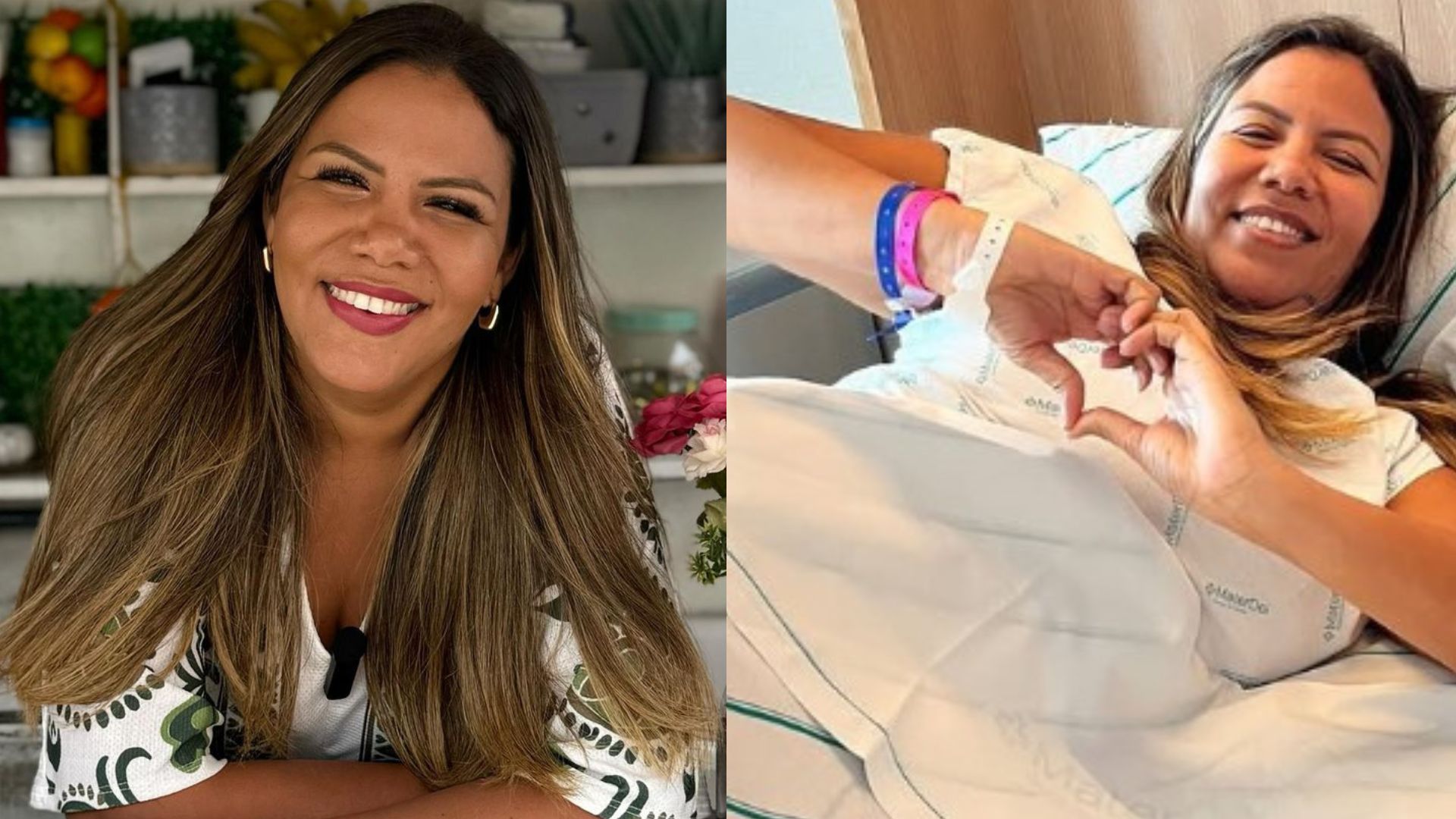 Mani Reggo explica decisão de realizar cirurgias plásticas