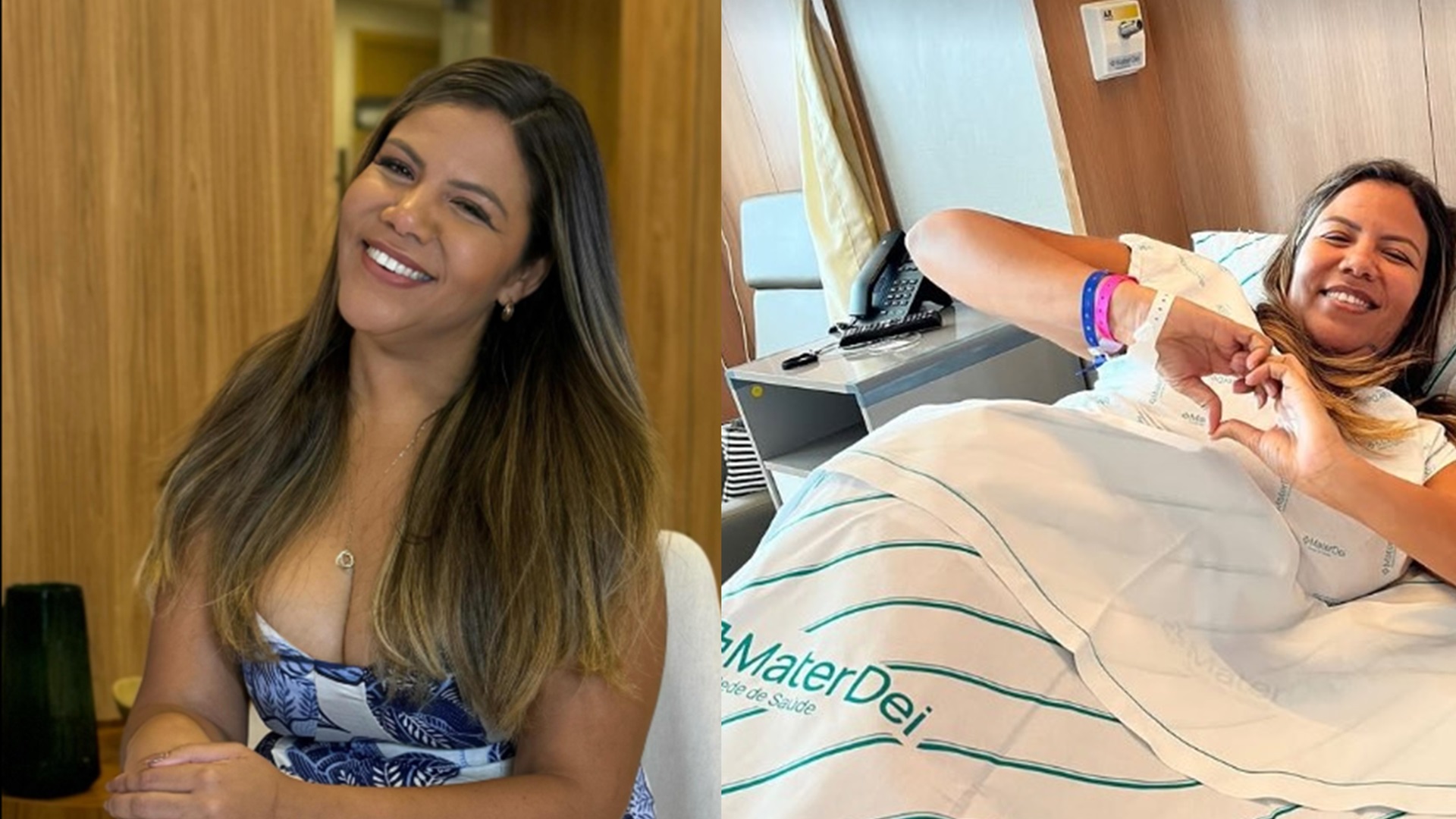 Mani Rego: saiba quanto custou a cirurgia plástica da ex de Davi Brito
