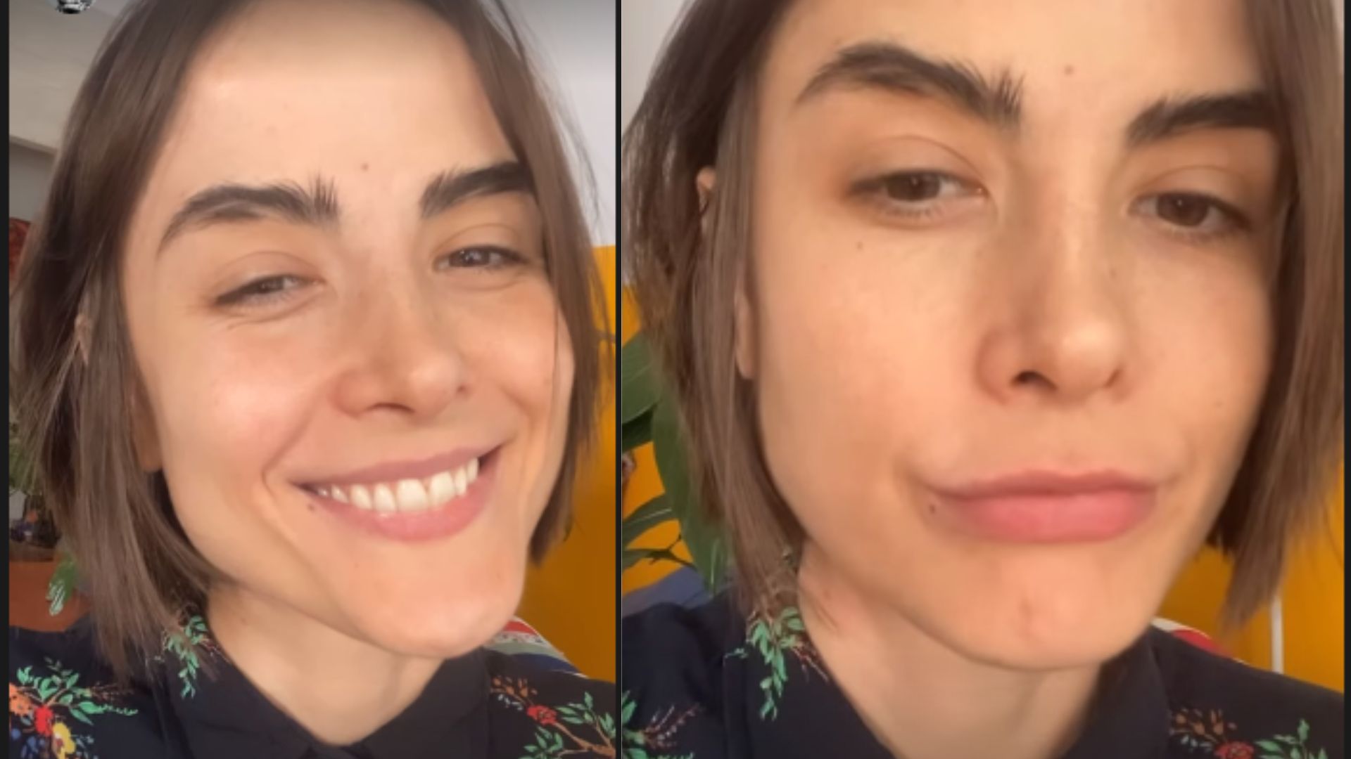Maria Casadevall descobre síndrome rara e passa por cirurgia