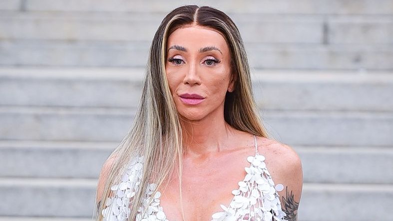Por que Maya Massafera ficou com o ‘umbigo triste’ antes de cirurgia? Médico explica