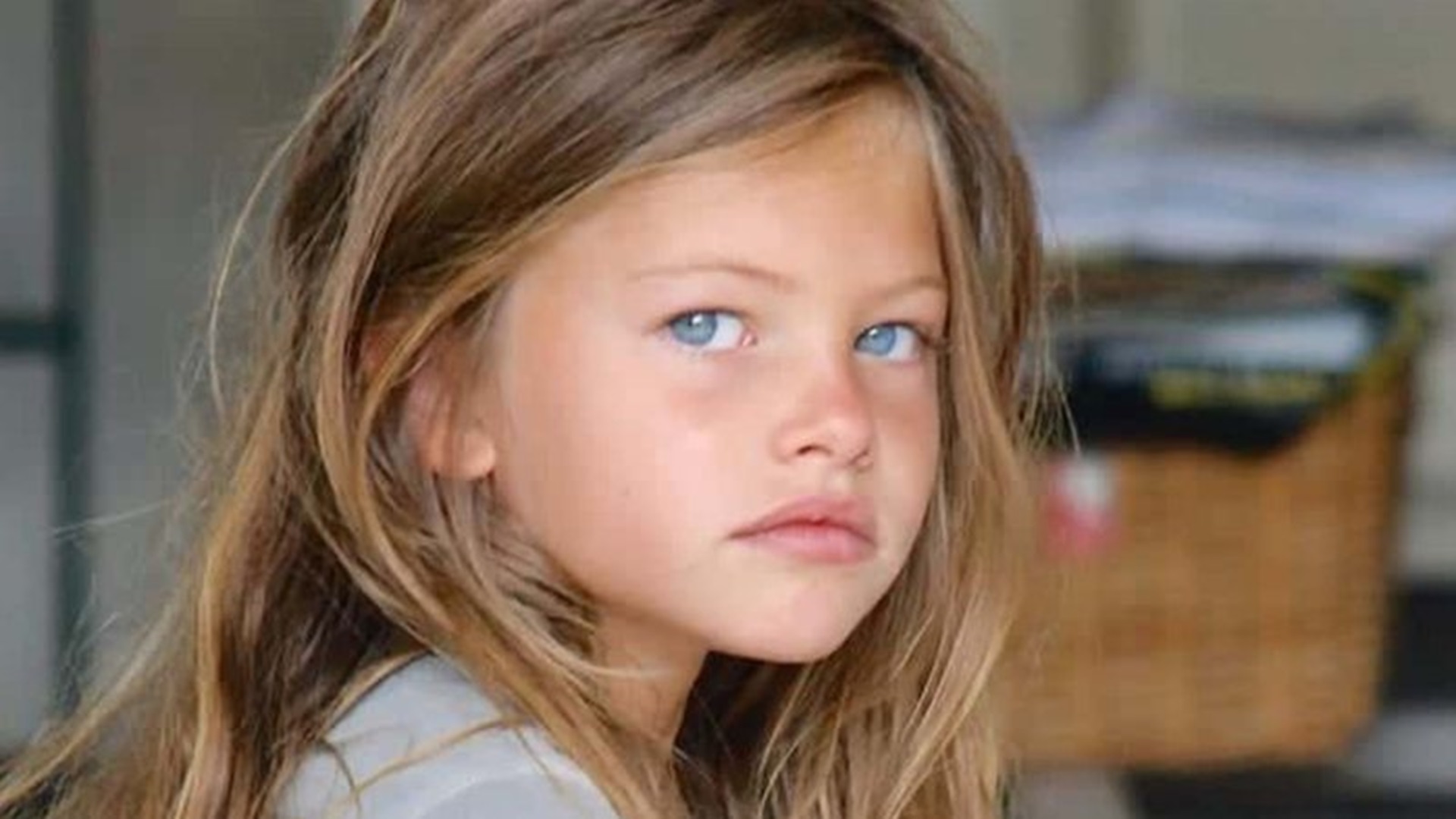 Como está hoje a ‘menina mais linda do mundo’? Modelo enfrentou diagnóstico