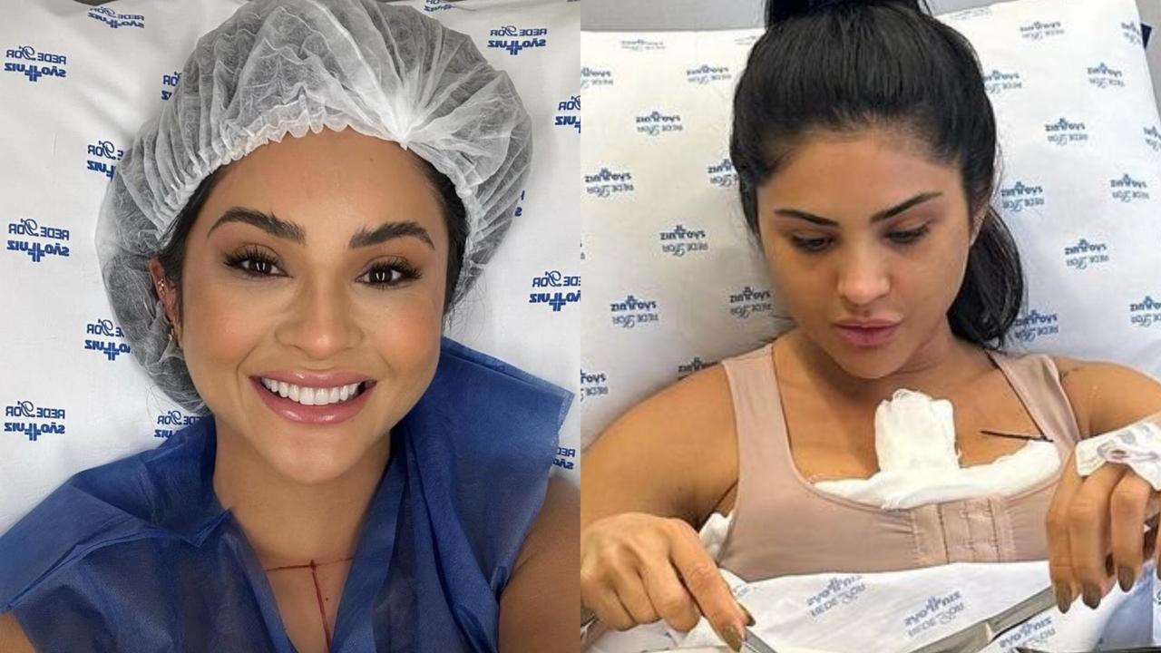 Mileide Mihaile se submete a nova cirurgia plástica: ‘Venci o medo e o trauma’