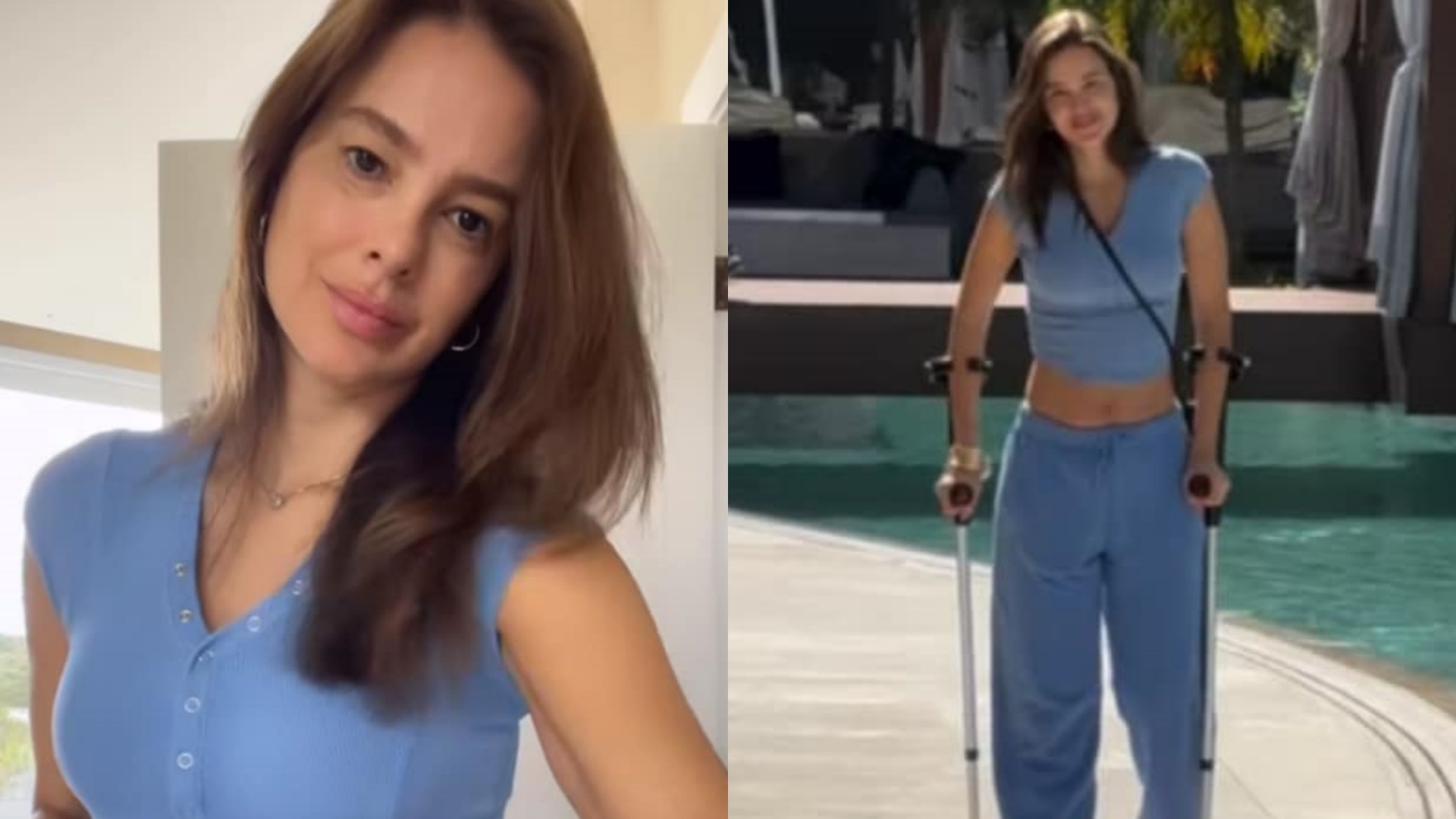 Vera Viel surge de muletas e fala sobre nova fase do tratamento: ‘Batalha’