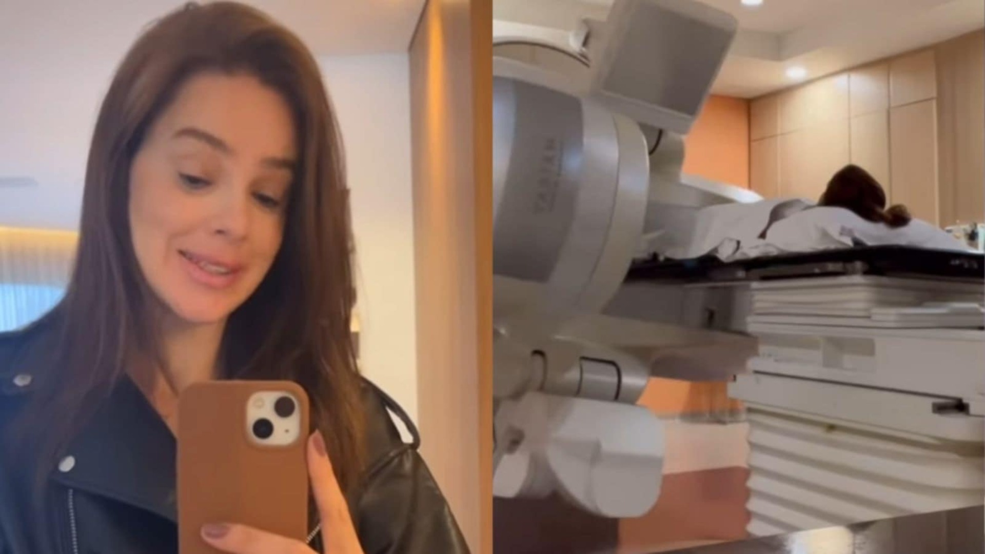 Vera Viel fala sobre efeitos colaterais da radioterapia: ‘Comecei a sentir’