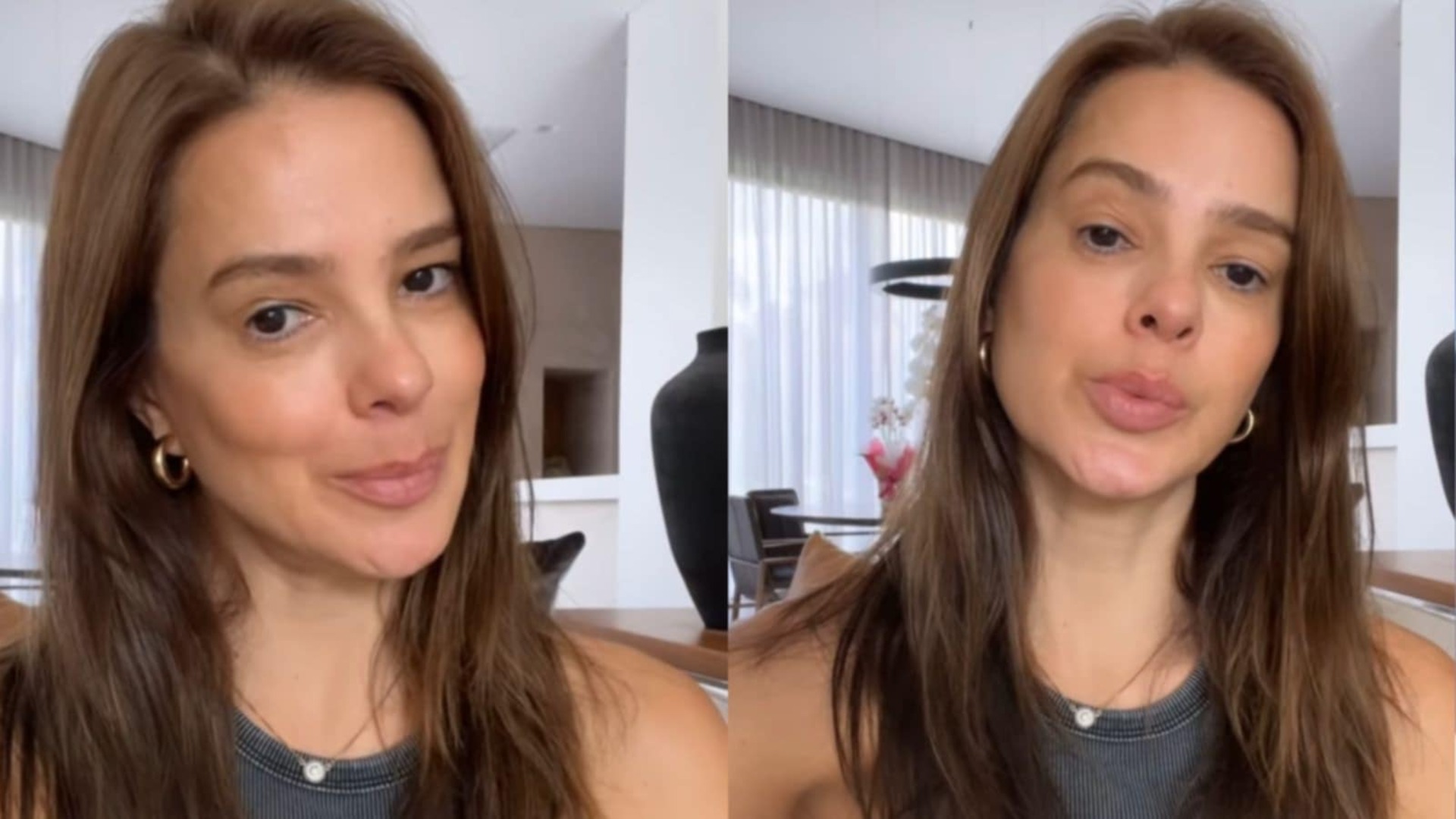Vera Viel fala sobre sua cicatriz na perna e motivo de usar muletas