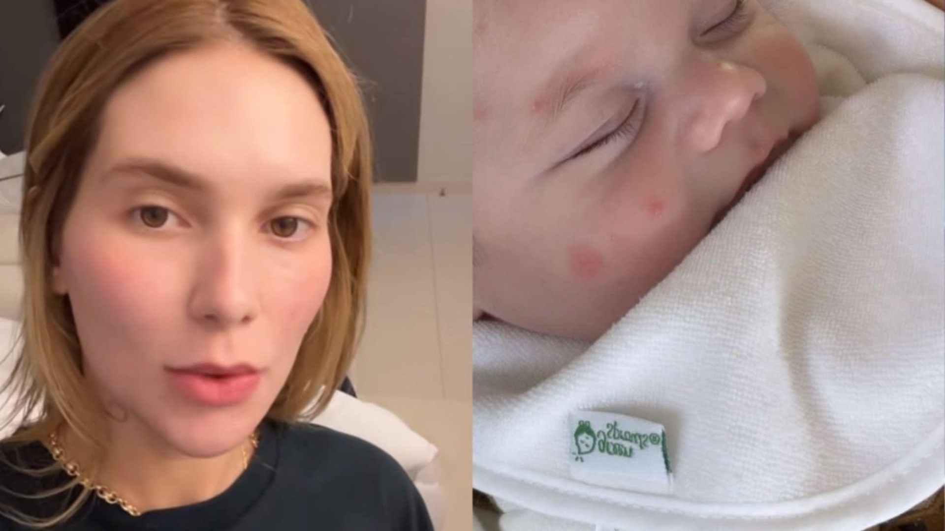 Em mansão de praia, Virginia mostra ataque de mosquitos que o filho sofreu
